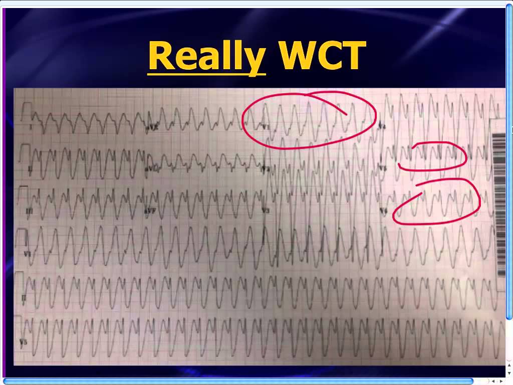 63  Amal Mattu Ecg Book for Kids