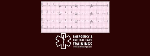 ECG: Arritmias Cardiacas ecctrainings